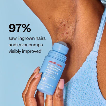 Glowline Razor Bump & Ingrown Hair Treatment